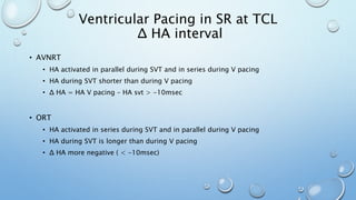 • AVNRT
• HA activated in parallel during SVT and in series during V pacing
• HA during SVT shorter than during V pacing
• Δ HA = HA V pacing – HA svt > -10msec
• ORT
• HA activated in series during SVT and in parallel during V pacing
• HA during SVT is longer than during V pacing
• Δ HA more negative ( < -10msec)
Ventricular Pacing in SR at TCL
Δ HA interval
 