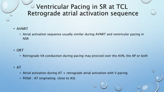• AVNRT
• Atrial activation sequence usually similar during AVNRT and ventricular pacing in
NSR
• ORT
• Retrograde VA conduction during pacing may procced over the AVN, the AP or both
• AT
• Atrial activation during AT ≄ retrograde atrial activation with V pacing
• Pitfall : AT originating close to AVJ
Ventricular Pacing in SR at TCL
Retrograde atrial activation sequence
 