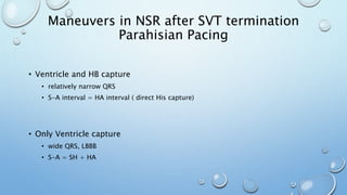 • Ventricle and HB capture
• relatively narrow QRS
• S-A interval = HA interval ( direct His capture)
• Only Ventricle capture
• wide QRS, LBBB
• S-A = SH + HA
Maneuvers in NSR after SVT termination
Parahisian Pacing
 