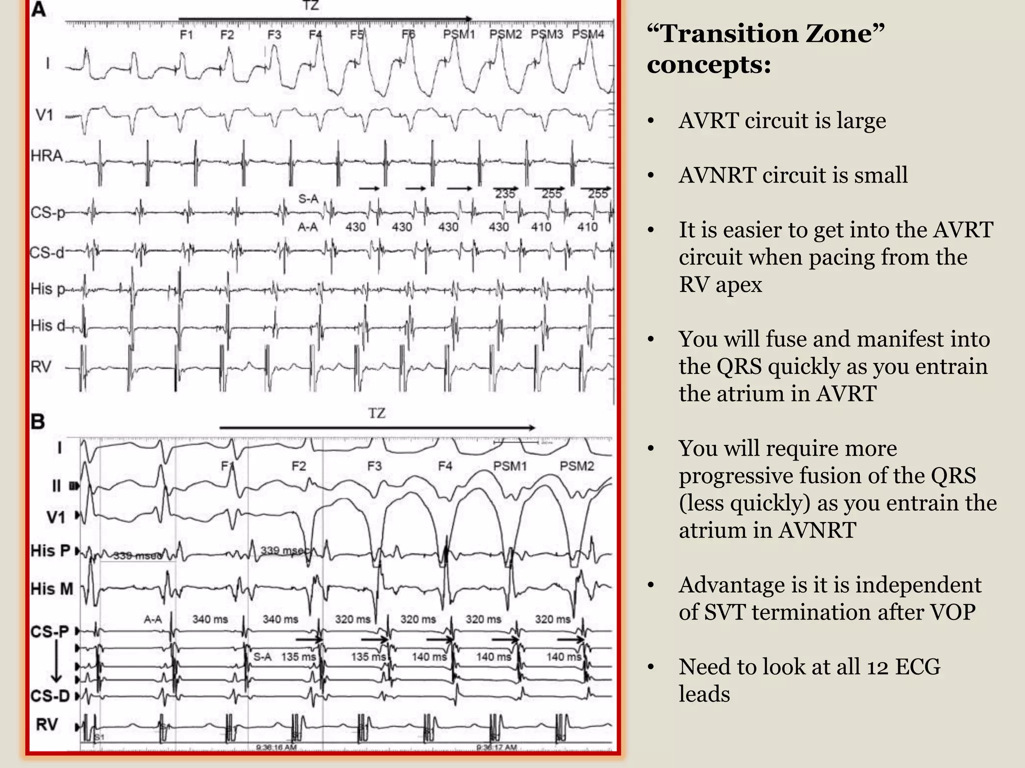 Svt maneuvers hany abed | PDF