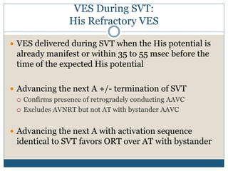 VES During SVT:
His Refractory VES
 VES delivered during SVT when the His potential is
already manifest or within 35 to 55 msec before the
time of the expected His potential
 Advancing the next A +/- termination of SVT
 Confirms presence of retrogradely conducting AAVC
 Excludes AVNRT but not AT with bystander AAVC
 Advancing the next A with activation sequence
identical to SVT favors ORT over AT with bystander
 