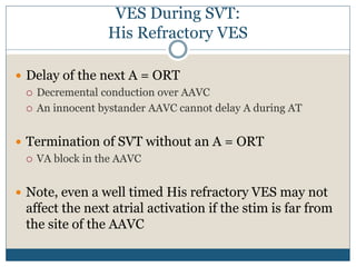 VES During SVT:
His Refractory VES
 Delay of the next A = ORT
 Decremental conduction over AAVC
 An innocent bystander AAVC cannot delay A during AT
 Termination of SVT without an A = ORT
 VA block in the AAVC
 Note, even a well timed His refractory VES may not
affect the next atrial activation if the stim is far from
the site of the AAVC
 