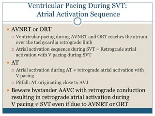  AVNRT or ORT
 Ventricular pacing during AVNRT and ORT reaches the atrium
over the tachycardia retrograde limb
 Atrial activation sequence during SVT = Retrograde atrial
activation with V pacing during SVT
 AT
 Atrial activation during AT ≠ retrograde atrial activation with
V pacing
 Pitfall: AT originating close to AVJ
 Beware bystander AAVC with retrograde conduction
resulting in retrograde atrial activation during
V pacing ≠ SVT even if due to AVNRT or ORT
Ventricular Pacing During SVT:
Atrial Activation Sequence
 