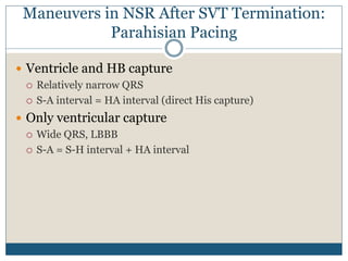 Maneuvers in NSR After SVT Termination:
Parahisian Pacing
 Ventricle and HB capture
 Relatively narrow QRS
 S-A interval = HA interval (direct His capture)
 Only ventricular capture
 Wide QRS, LBBB
 S-A = S-H interval + HA interval
 