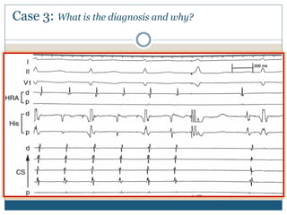 Case 3: What is the diagnosis and why?
 