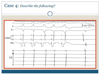 Case 4: Describe the following?
 