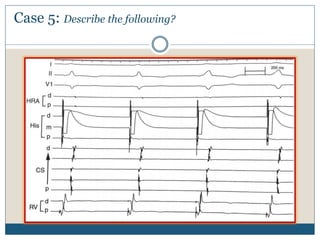 Case 5: Describe the following?
 
