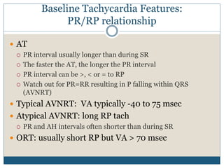 Baseline Tachycardia Features:
PR/RP relationship
 AT
 PR interval usually longer than during SR
 The faster the AT, the longer the PR interval
 PR interval can be >, < or = to RP
 Watch out for PR=RR resulting in P falling within QRS
(AVNRT)
 Typical AVNRT: VA typically -40 to 75 msec
 Atypical AVNRT: long RP tach
 PR and AH intervals often shorter than during SR
 ORT: usually short RP but VA > 70 msec
 