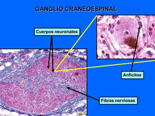 Cuerpos neuronales
Fibras nerviosas
Anficitos
GANGLIO CRANEOESPINAL
 