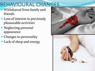 BEHAVIOURAL CHANGES
 Withdrawal from family and
    friends.
   Loss of interest in previously
    pleasurable activities
   Neglecting personal
    appearance
   Changes in personality
   Lack of sleep and energy
 
