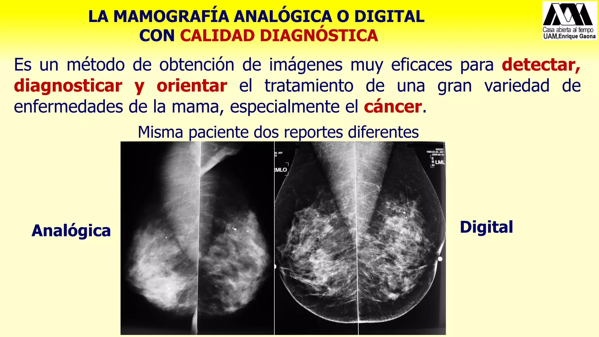 Protección Radiológica del Paciente y Control de Calidad en Mamografía