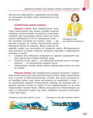 Домедична допомога при травмах окремих анатомічних ділянок
103
досягається нерухомість у променево-зап’ястному
та ліктьовому суглобах. Руку підвішують до шиї
на косинці.
Іммобілізація нижніх кінцівок
Перелом стегна. Для іммобілізації необ-
хідно знерухомити три великі суглоби нижньої
кінцівки: тазостегновий, колінний та гомілково­
стопний. Для шинування краще взяти дві тонкі
дошки завширшки 5–8 см і завдовжки: одну —
від пахвової западини до п’ятки, іншу — від
пахової складки до п’ятки. Підготовлені шини
обгорнути ватою по довжині. Якщо перелом за-
критий, шини слід накладати не знімаючи одягу. Постраждалого
слід покласти на рівну жорстку поверхню горілиць з припіднятою
головою, а потім:
ŠŠ зламану ногу обережно випрямити й прямою припідняти так,
щоб зручно було робити бинтові тури;
ŠŠ накласти шини: довгу — по зовнішній поверхні ноги та тулуба,
коротку — по внутрішній поверхні ноги;
ŠŠ спіральними турами бинта міцно прикріпити шини до ноги
та тулуба.
Перелом гомілки. Для іммобілізації нижньої кінцівки з перело-
мом великогомілкової або малогомілкової кістки треба знерухомити
ногу в коліні й гомілковостопному суглобі. Для цього накладаєть-
ся подвійна шина: одну шину накладають по зовнішній, а іншу —
по внутрішній поверхні пошкодженої гомілки від верхньої або се-
редньої третини стегна до ступні й туго прибинтовують їх до ноги
спіральними турами бинта. Шини накладаються безпосередньо на
одяг; за відсутності одягу під шину необхідно покласти підкладку
з вати або одягу.
Накладання шини
при переломі передпліччя
Накладання шини при переломі стегна	 Накладання шини при переломі гомілки
Право для безоплатного розміщення підручника в мережі Інтернет має
Міністерство освіти і науки України http://mon.gov.ua/ та Інститут модернізації змісту освіти https://imzo.gov.ua
 