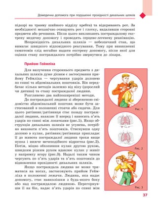 Домедична допомога при порушенні прохідності дихальних шляхів
37
підозрі на травму шийного відділу хребта) та відкривають рот. За
необхідності механічно очищують рот і глотку, видаливши сторонні
предмети або речовини. Після цього викликають постраждалому екс-
трену медичну допомогу і проводять серцево-легеневу реанімацію.
Непрохідність дихальних шляхів — небезпечний стан, що
вимагає швидкого відповідного реагування. Тому при виникненні
симптомів слід негайно надати екстрену допомогу, після якої для
оцінки стану постраждалого потрібно звернутися до лікаря.
Прийом Геймліха
Для вилучення стороннього предмета з ди-
хальних шляхів дуже дієвим є застосування при-
йому Геймліха — чергування ударів долонею
по спині та абдомінальних поштовхів. Він перед-
бачає кілька методів залежно від віку (дорослий
чи дитина) та стану постраждалої людини.
Розглянемо два найпоширеніші методи.
До постраждалої людини зі збереженою сві-
домістю абдомінальний поштовх може бути за-
стосований в положенні стоячи або сидячи. Для
цього рятівник/рятівниця стає позаду постраж-
далої людини, нахиляє її вперед і наносить п’ять
ударів по спині між лопатками (рис.1). Якщо об-
струкція дихальних шляхів не усунена, потріб-
но виконати п’ять поштовхів. Стиснувши одну
долоню в кулак, рятівник/рятівниця прикладає
її до живота постраждалої людини трохи вище
пупка і нижче мечеподібного відростка (рис.2).
Потім, міцно обхопивши кулак другою рукою,
швидким різким рухом вдавлює кулак у живіт
у напрямку вгору (рис.3). Надалі таким чином
чергують по п’ять ударів та п’ять поштовхів до
відновлення прохідності дихальних шляхів.
Якщо постраждала людина не може три-
матися на ногах, застосовують прийом Гейм-
ліха в положенні лежачи. Людина, яка надає
допомогу, стає навколішки з будь-якого боку
або над постраждалою людиною. Перегорнув-
ши її на бік, надає п’ять ударів по спині між
Рис. 2
Рис. 3
Рис. 1
Право для безоплатного розміщення підручника в мережі Інтернет має
Міністерство освіти і науки України http://mon.gov.ua/ та Інститут модернізації змісту освіти https://imzo.gov.ua
 