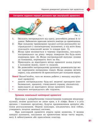 Надання домедичної допомоги при кровотечах
81
Алгоритм надання першої допомоги при внутрішній кровотечі
1.	 Звільніть постраждалого від одягу, розстебніть ремені й ґу-
дзики. Забезпечте приплив свіжого повітря до приміщення.
2.	 При сильному травмуванні грудної клітки розташуйте по-
страждалого у напівсидячому положенні, а під ноги йому
підкладіть невеликий валик із ковдри (рис. 1).
3.	 Якщо кров виливається в черевну порожнину, покладіть
постраждалого на рівну тверду поверхню без будь-яких
підвищень (рис. 2). Якщо постраждалий відчуває позиви
до блювання, переверніть його на бік.
4.	 Прикладіть до вірогідного місця кровотечі холод (грілку
з холодною водою, пакет із льодом).
5.	 Не дозволяйте постраждалому рухатися, розмовляти (це мо-
же спричинити погіршення стану). Якщо людину мучить
спрага, слід допомогти їй прополоскати рот холодною водою.
Увага! Запам’ятайте, чого не можна робити у випадку внутріш-
ньої кровотечі:
ŠŠ давати постраждалому будь-які медичні препарати (зне-
болювальні, проносні, стимулюючі серцеву діяльність);
ŠŠ прикладати до вірогідного місця кровотечі тепло;
ŠŠ напувати постраждалого або годувати.
Зупинка зовнішньої капілярної кровотечі
Капіляри є найдрібнішими тонкостінними судинами мікроцир-
куляції, якими рухається не лише кров, а й лімфа. Вони є в усіх
органах і тканинах організму, будучи продовженням артеріол або
їхнім розгалуженням. Окремі капіляри, поєднуючись між собою,
утворюють початок венозної системи.
При капілярній кровотечі втрата крові незначна, її можна
швидко зупинити, наклавши на кровоточиве місце чисту марлю,
вату й забинтувавши або приклеївши пластир.
Рис. 1 Рис. 2
Право для безоплатного розміщення підручника в мережі Інтернет має
Міністерство освіти і науки України http://mon.gov.ua/ та Інститут модернізації змісту освіти https://imzo.gov.ua
 