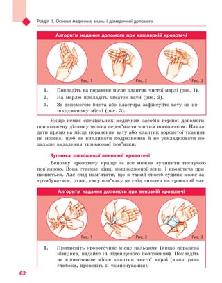 Розділ 1. Основи медичних знань і домедичної допомоги
82
Алгоритм надання допомоги при капілярній кровотечі
1.	 Покладіть на поранене місце клаптик чистої марлі (рис. 1).
2.	 На марлю покладіть шматок вати (рис. 2).
3.	 За допомогою бинта або пластира зафіксуйте вату на по-
шкодженому місці (рис. 3).
Якщо немає спеціальних медичних засобів першої допомоги,
пошкоджену ділянку можна перев’язати чистим носовичком. Накла-
дати прямо на місце поранення вату або клаптик ворсистої тканини
не можна, щоб не викликати подразнення й не ускладнювати по-
дальше видалення тимчасової пов’язки.
Зупинка зовнішньої венозної кровотечі
Венозну кровотечу краще за все можна зупинити тиснучою
пов’язкою. Вона стискає кінці пошкодженої вени, і кровотеча при-
пиняється. Але слід пам’ятати, що в такий спосіб судина може за-
тромбуватися, отже, таку пов’язку не слід лишати на тривалий час.
Алгоритм надання допомоги при венозній кровотечі
1.	 Притисніть кровоточиве місце пальцями (якщо поранена
кінцівка, надайте їй підвищеного положення). Покладіть
на кровоточиве місце клаптик чистої марлі (якщо рана
глибока, проведіть її тампонування).
Рис. 1
Рис. 1
Рис. 2
Рис. 2
Рис. 3
Рис. 3
Право для безоплатного розміщення підручника в мережі Інтернет має
Міністерство освіти і науки України http://mon.gov.ua/ та Інститут модернізації змісту освіти https://imzo.gov.ua
 