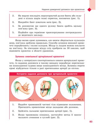 Надання домедичної допомоги при кровотечах
83
2.	 На марлю покладіть нерозгорнутий рулон бинта або скла-
дені в кілька шарів ткані серветки, носовичок (рис. 1).
3.	 Накрийте бинт шматком вати (рис. 2).
4.	 За допомогою ще одного рулону бинта зробіть щільну
пов’язку (рис. 3).
5.	 Подбайте про термінове транспортування постраждалого
до медичного закладу.
Якщо вилив крові зупинився, але нижче зберігається пульсація
вени, пов’язка зроблена правильно. Способи зупинки венозної крово-
течі передбачають і вплив холодом. Міхур із льодом можна покласти
на пов’язку. За півгодини міхур слід прибрати на 10 хвилин, щоб
відновити кровоток в області ураження.
Зупинка зовнішньої артеріальної кровотечі
Якщо у потерпілого спостерігаються ознаки артеріальної крово-
течі, то надання допомоги в такому випадку передбачає перетискан-
ня пошкодженої судини вище пошкодженого місця. Зупинка втрати
крові відбудеться тільки в разі притискання артерії до кістки.
Алгоритм надання допомоги при артеріальній кровотечі
1.	 Надайте травмованій частині тіла підвищене положення.
Притисніть кровоточиве місце пальцями або долонею.
2.	 Здійсніть пальцеве притискання артерії (рис. 1).
3.	 Якщо травмована кінцівка, застосуйте метод її макси-
мального згинання в суглобі (рис. 2).
Рис. 1 Рис. 2 Рис. 3
Право для безоплатного розміщення підручника в мережі Інтернет має
Міністерство освіти і науки України http://mon.gov.ua/ та Інститут модернізації змісту освіти https://imzo.gov.ua
 