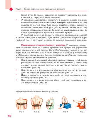 Розділ 1. Основи медичних знань і домедичної допомоги
86
іншої руки із силою натискає на пахвову западину по лінії,
ближчої до передньої межі западини.
ŠŠ У випадках артеріальної кровотечі в області нижніх кінцівок
пальцеве притискання стегнової артерії спрямоване в пахову
область до кісток тазу. Для цього потрібно сильно натиснути
великими пальцями обох рук (або кулаком однієї) на пахову
область постраждалого, дещо ближче до внутрішнього краю, де
чітко простежується пульсація стегнової артерії.
У подібний спосіб здійснюють пальцеве притискання артерій
в інших випадках кровотечі. Цей спосіб допомагає зберегти доро-
гоцінний час у рятуванні людини й наданні подальшої допомоги.
Максимальне згинання кінцівок у  суглобах. У випадках травму-
вання кінцівок після пальцевого притискання артерії для утримання
крові застосовують цей метод. Його обов’язковою умовою є те, що
перед тим, як максимально зігнути кінцівку у суглобі, у місце згину
необхідно підкласти валик. Окрім спеціальних засобів для стягнення
кінцівок можна скористатися ременем.
ŠŠ При кровотечі з верхньої кінцівки використовують тугий валик
розміром з кулак потерпілого, який підкладають у підпахвову
ділянку, плече щільно фіксують до тулуба до повної зупинки
кровотечі (рис. 1).
ŠŠ При кровотечі з підключичної або плечової артерії руки заво-
дять за спину та фіксують їх пов’язкою (рис. 2).
ŠŠ Якщо кровоточать судини передпліччя, руку згинають у лік-
тьовому суглобі (рис. 3).
ŠŠ При кровотечі з рани гомілки або ступні ногу згинають у ко-
лінному суглобі (рис. 4).
Метод максимального згинання кінцівок у  суглобах
Рис. 1 Рис. 2 Рис. 3 Рис. 4 Рис. 5
Право для безоплатного розміщення підручника в мережі Інтернет має
Міністерство освіти і науки України http://mon.gov.ua/ та Інститут модернізації змісту освіти https://imzo.gov.ua
 