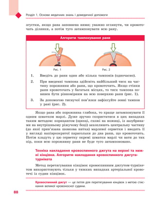 Розділ 1. Основи медичних знань і домедичної допомоги
88
згустки, якщо рана заповнена ними; уважно оглянути, чи кровото-
чать ділянки, а потім туго затампонувати всю рану.
Алгоритм тампонування рани
		 Рис. 1	 Рис. 2
1.	 Введіть до рани один або кілька тампонів (одночасно).
2.	 При введенні тампона здійсніть найбільший тиск на час-
тину порожнини або рани, що кровоточить. Якщо стінки
рани кровоточать у багатьох місцях, то тиск тампона по-
винен бути рівномірним на всю поверхню рани (рис. 1).
3.	 За допомогою тиснучої пов’язки зафіксуйте зовні тампон
у рані (рис. 2).
Якщо рана або порожнина глибока, то краще затампонувати її
одним шматком марлі. Дуже зручно скористатися в цих випадках
таким методом: корнцангом (щипці, схожі на ножиці, із зазубрина-
ми на внутрішньому ріжучому боці) захоплюють центральну частину
(до якої прив’язана шовкова нитка) марлевої серветки і вводять її
у вигляді напіврозкритої парасольки до дна рани, що кровоточить.
Потім кладуть у цю серветку окремі шматки марлі чи вати до тих
пір, поки всю порожнину рани не буде туго затампоновано.
Техніка накладання кровоспинного джгута на верхні та  ниж-
ні кінцівки. Алгоритм накладання кровоспинного джгута-
турнікета
Метод перетягування кінцівок кровоспинним джгутом-турніке-
том використовують тільки у тяжких випадках артеріальної крово-
течі із судин кінцівок.
Кровоспинний джгут — це петля для перетягування кінцівок з метою стис-
кання великої кровоносної судини.
Право для безоплатного розміщення підручника в мережі Інтернет має
Міністерство освіти і науки України http://mon.gov.ua/ та Інститут модернізації змісту освіти https://imzo.gov.ua
 