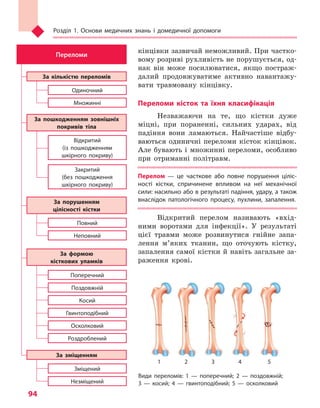 Розділ 1. Основи медичних знань і домедичної допомоги
94
кінцівки зазвичай неможливий. При частко-
вому розриві рухливість не порушується, од-
нак він може посилюватися, якщо постраж­
далий продовжуватиме активно навантажу-
вати травмовану кінцівку.
Переломи кісток та  їхня класифікація
Незважаючи на те, що кістки дуже
міцні, при пораненні, сильних ударах, від
падіння вони ламаються. Найчастіше відбу-
ваються одиничні переломи кісток кінцівок.
Але бувають і множинні переломи, особливо
при отриманні політравм.
Перелом  — це часткове або повне порушення ціліс-
ності кістки, спричинене впливом на неї механічної
сили: насильно або в результаті падіння, удару, а також
внаслідок патологічного процесу, пухлини, запалення.
Відкритий перелом називають «вхід-
ними воротами для інфекції». У результаті
цієї травми може розвинутися гнійне запа-
лення м’яких тканин, що оточують кістку,
запалення самої кістки й навіть загальне за-
раження крові.
Відкритий
(із пошкодженням
шкірного покриву)
Поперечний
Повний
Зміщений
Одиночний
Неповний
Незміщений
Множинні
Поздовжній
Косий
Гвинтоподібний
Осколковий
Роздроблений
Закритий
(без пошкодження
шкірного покриву)
Переломи
За пошкодженням зовнішніх
покривів тіла
За формою
кісткових уламків
За порушенням
цілісності кістки
За зміщенням
За кількістю переломів
Види переломів: 1  — поперечний; 2  — поздовжній;
3  — косий; 4  — гвинтоподібний; 5  — осколковий
1	 2	 3	 4	 5
Право для безоплатного розміщення підручника в мережі Інтернет має
Міністерство освіти і науки України http://mon.gov.ua/ та Інститут модернізації змісту освіти https://imzo.gov.ua
 