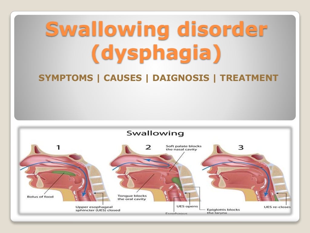 Swallowing disorder (dysphagia) in children Causes, Symptoms, Diagno…