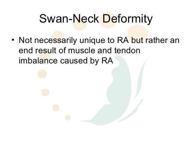 swan bands
