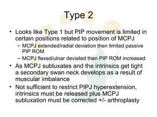 Pip Rom Swan neck deformityw | PPT
