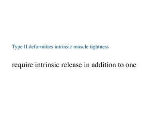 Type II deformities intrinsic muscle tightness
require intrinsic release in addition to one
 