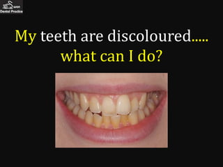 My teeth are discoloured.....
      what can I do?
 