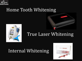 Home Tooth Whitening



        True Laser Whitening


Internal Whitening
 