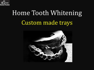 Home Tooth Whitening
  Custom made trays
 