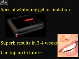 Special whitening gel formulation




Superb results in 3-4 weeks

Can top up in future
 