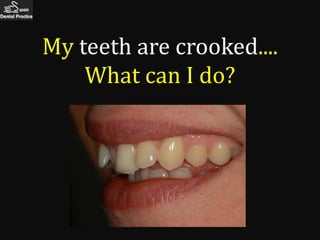 My teeth are crooked....
    What can I do?
 