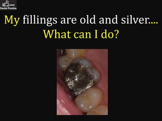 My fillings are old and silver....
        What can I do?
 