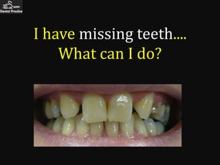 I have missing teeth....
    What can I do?
 