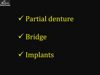  Partial denture

 Bridge

 Implants
 