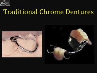 Traditional Chrome Dentures
 