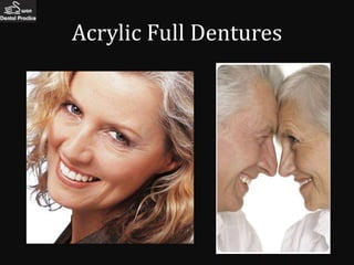 Acrylic Full Dentures
 