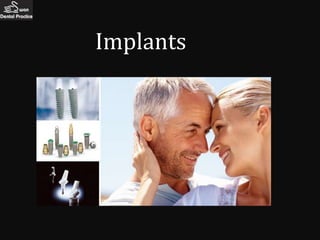 Implants
 