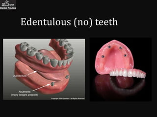 Edentulous (no) teeth
 