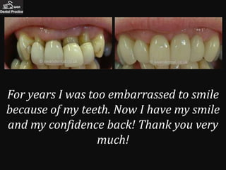 For years I was too embarrassed to smile
because of my teeth. Now I have my smile
and my confidence back! Thank you very
                  much!
 