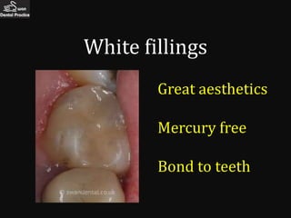 White fillings
        Great aesthetics

        Mercury free

        Bond to teeth
 