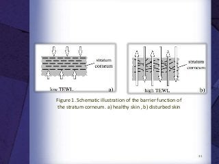31
Figure 1. Schematic illustration of the barrier function of
the stratum corneum. a) healthy skin , b) disturbed skin
 