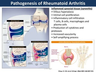 Choy, E. H.S. et al. N Engl J Med 2001;344:907-916
Inflammed synovial tissue (synovitis)
• Villous hyperplasia
• Intimal cell proliferation
• Inflammatory cell infiltration
T cells, B cells, macrophages and
plasma cells
• Production of cytokines and
proteases
• Increased vascularity
• Self-amplifying process
Pathogenesis of Rheumatoid Arthritis
27-07-2013
 