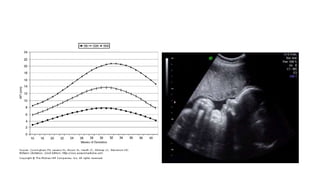 Phelan Normal AMNIOTIC FLUID PPT | PPTX