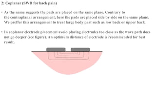 2: Coplanar (SWD for back pain)
• As the name suggests the pads are placed on the same plane. Contrary to
the contraplanar arrangement, here the pads are placed side by side on the same plane.
We preffer this arrangement to treat large body part such as low back or upper back.
• In coplanar electrode placement avoid placing electrodes too close as the wave path does
not go deeper (see figure). An optimum distance of electrode is recommended for best
result.
 
