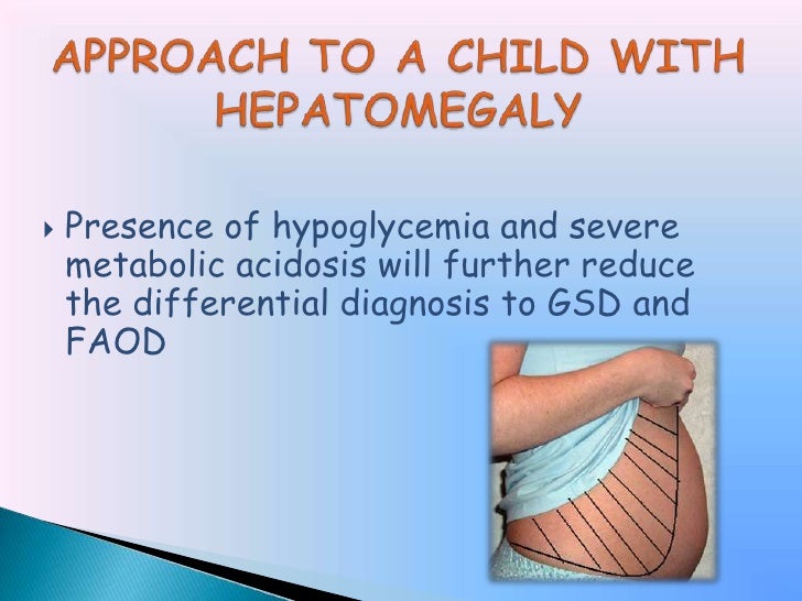 Dr Swati Case Of Hepatomegaly