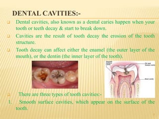  Oral cavity related problems