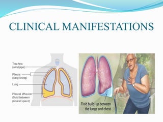 CLINICAL MANIFESTATIONS
 