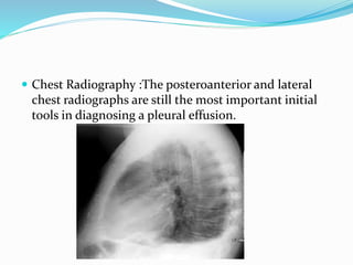  Chest Radiography :The posteroanterior and lateral
chest radiographs are still the most important initial
tools in diagnosing a pleural effusion.
 