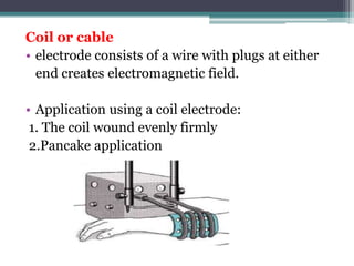 Coil or cable
• electrode consists of a wire with plugs at either
end creates electromagnetic field.
• Application using a coil electrode:
1. The coil wound evenly firmly
2.Pancake application
 